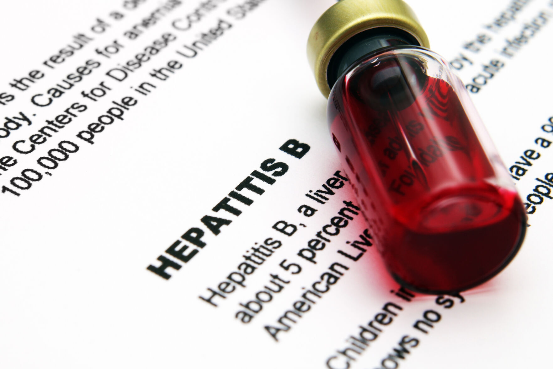 Hepatitis